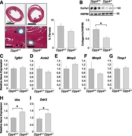 Figure 2. Fibrosis is decreased in euglycemic Dpp4−/− mice compared with littermate controls. A, Trichrome staining and quantitation of sectioned hearts from Dpp4−/− mice compared with littermate controls (n = 4–5). Arrows represent areas of trichrome staining. B, Western blotting analysis of Col1a1 normalized to HSP90. Relative levels of ventricular mRNA of the hypertrophic markers Tgfb1 (C), Acta2 (D), Mmp2 (E), Mmp9 (F), Timp1 (G), Vim (H), and Ddr2 (I). All values are the mean ± SEM (n = 4–5, *P < 0.05).