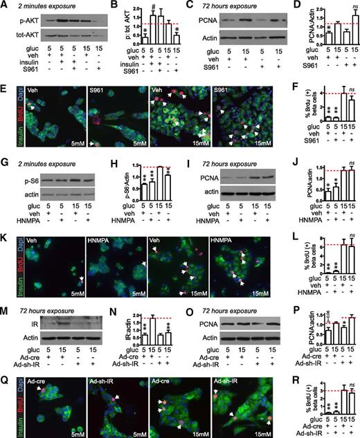 Figure 2. Glucose-induced proliferation in mouse islets does not require the insulin receptor (IR). A–L: IR blockers S961 (A–F; 100 nmol/L added 120 min before glucose or insulin [100 nmol/L] stimulation) or HNMPA (G–L; 10 μmol/L added 60 min before glucose stimulation) prevented activation of insulin signaling 2 min after glucose treatment (whole islets, n = 4; A and B and G and H) but did not prevent the glucose-induced increase in PCNA abundance after 72 h of glucose treatment (whole islets, n = 3–4; C and D and I and J) or the glucose-induced increase in the percent of β-cells incorporating BrdU (dispersed islets, n = 4–8; E and F and K and L). Adenovirus expressing an shRNA targeting the mouse IR (MOI 50) in dispersed islets reduced IR expression 72 h after glucose exposure (n = 5; M and N) but did not prevent the glucose-induced increase in PCNA abundance (n = 5; O and P) or β-cell BrdU incorporation (n = 4; Q and R). Arrows point to BrdU-positive β-cell nuclei. Data are mean ± SEM. *P < 0.05, **P < 0.01 vs. 15 mmol/L glucose control condition (marked by dotted line); #P < 0.05 vs. 5 mmol/L control. gluc, glucose; ns, not significant; p, phosphorylated; tot, total; veh, vehicle.