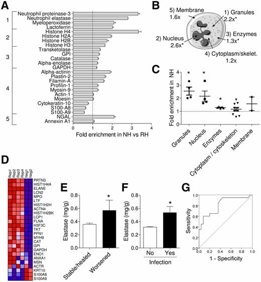 Figure 1. Proteomic analysis of diabetic wound lysates. A: Proteins belonging to the custom NETosis pathway are shown with their fold enrichment in NH vs. RH wounds. Error bars were derived from internal technical triplicates of the iTRAQ labels. The dashed line at onefold change aids visual identification of proteins with significant enrichment or depletion in NH vs. RH. Numbers on the left identify the belonging cellular compartment illustrated in B. B: Average fold enrichment for proteins in each subcellular compartment in NH vs. RH of proteins in the custom NETosis pathway (*P < 0.05). skelet., cytoskeleton. C: Fold enrichment in NH vs. RH with dispersion shown by individual dots of NETosis pathway proteins grouped according to subcellular compartment (*P < 0.05 compared with 1.0). D: Profile plot from the GSEA showing highly significant enrichment of most proteins in the custom NETosis pathway in the 4 replicates (Rep1–Rep4) compared with negative control subjects (Neg1, Neg2). False discovery rate–adjusted P value for this analysis, according to GSEA output, was <0.001, and normalized enrichment score was 2.06. E: Wound elastase content (measured as mg elastase/g tissue) in patients of the validation cohort showing stable/healed wounds vs. in those showing worsening wound evolution (*P < 0.05). F: Wound elastase content in patients of the validation cohort with and without microbiologically proven infection (*P < 0.05). G: Receiver operating characteristic curve showing the accuracy of wound elastase content in discriminating presence/absence of infection.