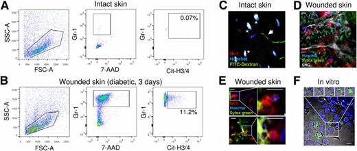 Figure 5. NETosis in mouse wound healing. A: A representative FACS plot showing that Gr-1+ neutrophils are very rare in the tissue lysate of the intact unwounded skin and that a negligible fraction (<0.1%) is positive for the citrullinated H3/H4 histones. B: A representative FACS plot showing that Gr-1+ neutrophils accumulate in the skin lysate of diabetic mice 3 days after wounding and that >10% are positive for the citrullinated H3/H4 histones and thereby undergoing NETosis. C: Intravital microscopy imaging of neutrophils and the vasculature in the intact skin. Gr-1+ neutrophils (red, arrow) were almost never seen in the extravascular space and occasionally were detected while flowing through skin capillaries, stained in green with high–molecular weight fluorescein isothiocyanate (FITC)–conjugated dextran. *Autofluorescence of hair bulbs. D: Intravital microscopy imaging of Gr-1+ neutrophils (red) infiltrating the wound bed 3 days after wounding. Nuclei are counterstained in blue with cell-permeable Hoechst 33342, whereas extracellular cell-free dsDNA is stained in green with the cell-impermeable Sytox green dye. The white signal of second harmonic generation (SHG) identifies collagen and blood vessels. The snapshot features a region of the wound bed rich in neutrophils, some of which show unlobulated nuclei or are devoid of nuclear staining, and extensive staining for extracellular dsDNA with Sytox green. E: Higher magnification details of the wound bed showing Gr-1+ (red) neutrophils with decondensed chromatin and/or delobulated nuclei caught in the process of casting NETs, evidenced by the Sytox green staining in the close vicinity (areas in the inserts are magnified). F: Live in vitro recording of neutrophils labeled with Hoechst 33342 and stimulated with PMA, showing NETosis at different stages. Some neutrophils have intact lobulated nuclei with bright Hoechst 33342 signal and some have already undergone NET release (Sytox green in the medium stains extracellular dsDNA), whereas others are in the process of chromatin decondensation (low Hoechst 33342 staining intensity and nuclear delobulation). One of these is highlighted in the box, and the snapshots taken from Supplementary Video 1 show further nuclear decondensation and chromatin extrusion. Scale bar 10 μm from C to F. 7-AAD, 7-aminoactinomycin D; Cit-H3/4, citrullinated histones H3/H4; SSC-A, side scatter A; FSC-A, forward scatter A.