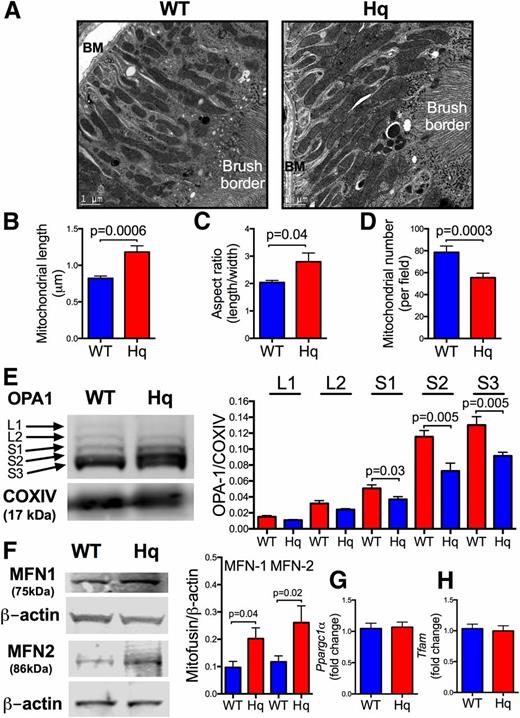 Figure 3. AIF knockdown mediates mitochondrial fusion events. A: Electron micrographs of renal PTECs showing mitochondrial morphology in WT (left) and Hq (right) mice. BM, basement membrane. Original magnification ×15,000. Scale bar = 1 μm. B: Mitochondrial length measured using ImageJ. Data are reported as the mean ± SEM, n = 5–6 images/mouse (with up to 115 mitochondria scored in each image), n = 3 mice/group. C: Mitochondrial aspect ratio (length/width). Data are mean ± SEM, n = 5–6 images/mouse (with up to 115 mitochondria scored in each image), n = 3 mice/group. D: Mitochondrial number per field. Data are the mean ± SEM, n = 5–6 images/mouse, n = 3 mice/group. E, Left: Representative Western blot (gradient gel) of OPA1 in showing the five isoforms: long isoforms 1 and 2 (L1 and L2) and short isoforms 1–3 (S1, S2, and S3) (spanning 80–100 kDa). COX IV loading control (bottom). Right: Quantitation of OPA1 Western blot, n = 8 mice/group. F, Left: Representative Western blot of MFN1 and MFN with β-actin loading controls beneath. Right: Quantitation of MFN1 and MFN2 Western blots relative to β-actin, n = 6–8 mice/group. qPCR analysis of genes involved in mitochondrial biogenesis: Ppargc1α (G) and Tfam (H) in renal cortex of WT mice and Aifm1Hq/Y (Hq) mice. n = 14 mice/group.