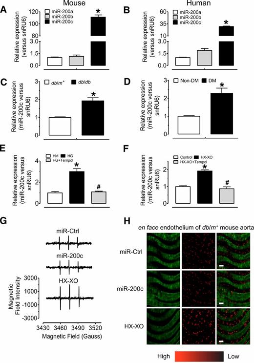 Figure 1. The elevated expression of miR-200c in diabetic db/db mouse aortas and in HG-treated MAECs. A and B: Real-time qPCR analysis of miR-200a, -b, and -c expression in db/m+ mouse aortas (A) and in human renal arteries (B). *P < 0.05 vs. miR-200a. C: qPCR analysis of miR-200c expression in nondiabetic or diabetic mouse aortas. *P < 0.05 vs. db/m+. D: miR-200c expression in renal arteries from subjects without diabetes (non-DM) and patients with diabetes (DM). *P < 0.05 vs. non-DM. E: qPCR assay of miR-200c expression in MAECs incubated in high mannitol (HM) (25 mmol/L + 5 mmol/L glucose, 24 h) or HG (30 mmol/L, 24 h) in the presence or absence of tempol (100 μmol/L). *P < 0.05 vs. HM; #P < 0.05 vs. HG. F: qPCR assay of miR-200c expression in MAECs incubated in HX-XO (100 μmol/L hypoxanthine + 0.01 units/mL xanthine oxidase, 24 h) in the presence or absence of tempol (100 μmol/L). *P < 0.05 vs. control; #P < 0.05 vs. HX-XO. G and H: The effect of miR-200c overexpression on ROS production as measured by EPR spectroscopy (G) and in situ DHE staining of endothelium of mouse aortas (H). Scale bar = 40 μm. Data are mean ± SEM of 4–5 experiments.