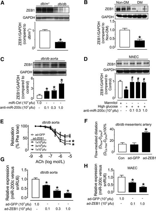 Figure 4. ZEB1 expression is decreased in diabetic mouse aortas and ad-ZEB1 transduction improves endothelial function in diabetic mice. A: Western blotting analysis of ZEB1 expression in db/m+ or db/db mouse aortas. *P < 0.05 vs. db/m+. B: ZEB1 expression in renal arteries from human subjects without diabetes (non-DM) and with diabetes (DM). *P < 0.05 vs. non-DM. C: Ad-anti–miR-200c (24 h) increased ZEB1 expression in db/db mouse aortas in a dose-dependent manner. *P < 0.05 vs. miR-Ctrl. D: Ad-anti–miR-200c reversed the HG (30 mmol/L, 24 h)-induced reduction in ZEB1 expression in MAECs. *P < 0.05 vs. mannitol; #P < 0.05 vs. HG. E and F: Ad-ZEB1 transduction enhanced endothelial function in both aortas and mesenteric arteries in db/db mice. *P < 0.05 vs. ad-GFP. G: Ad-ZEB1 transduction reduced miR-200c level in db/db mouse aortas. *P < 0.05 vs. ad-GFP. H: The effect of ad-ZEB1 transduction on miR-200c expression in MAECs. *P < 0.05 vs. ad-GFP. Data are mean ± SEM of 4–5 experiments. Con, control; Phe, phenylephrine; Phe tone, percentage of tension with phenylephrine contraction.