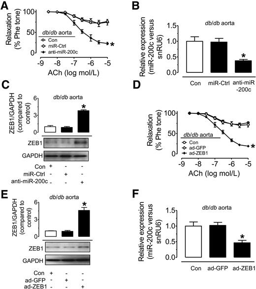 Figure 5. In vivo delivery of ad-anti–miR-200c or ad-ZEB1 suppresses miR-200c expression and improves endothelial function in db/db mice. A: Ad-anti–miR-200c in vivo improved EDRs in db/db mouse aortas. *P < 0.05 vs. miR-Ctrl. B and C: In vivo ad-anti–miR-200c transduction suppressed miR-200c expression and increased ZEB1 expression in db/db mouse aortas. *P < 0.05 vs. miR-Ctrl. D: In vivo ad-ZEB1 transduction improved EDRs in db/db mouse aortas. *P < 0.05 vs. ad-GFP. E and F: Ad-ZEB1 transduction increased ZEB1 expression and suppressed miR-200c expression in db/db mouse aortas. *P < 0.05 vs. ad-GFP. Data are mean ± SEM of 4–5 experiments. Con, control; Phe tone, percentage of tension with phenylephrine contraction.