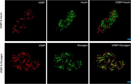 Figure 5. Immunohistochemical localization of VDBP in human pancreatic islets. Immunofluorescent double staining was performed to detect VDBP and glucagon (in α-cells) or insulin (in β-cells) in human pancreas sections obtained from an islet autoantibody-positive individual (nPOD ID #6090 [VDBP + insulin] and #6170 [VDBP + glucagon]). Frozen sections were incubated with anti-VDBP and antiglucagon or anti-insulin antibodies followed by incubation in secondary antisera conjugated to Alexa Fluor 594 (red) or Alexa Fluor 488 (green). Colocalization is shown in yellow. Scale bar = 25 μm.