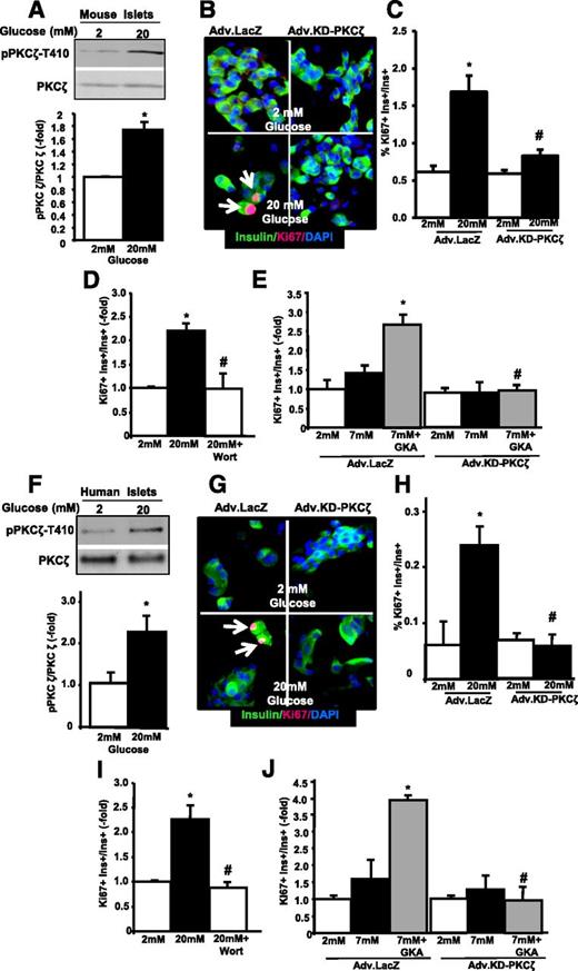 Figure 2. Glucose activates PKCζ in mouse and human islets, and transfer of KD-PKCζ completely blocks glucose-induced β-cell proliferation. A: Representative image of a Western blot showing the level and phosphorylation of PKCζ in mouse islets treated with 2 or 20 mmol/L glucose for 5 min and the densitometric quantitation of n = 4 experiments. B: Representative photomicrographs of mouse islet cell cultures transduced with Adv.LacZ or Adv.KD-PKCζ, treated with 2 or 20 mmol/L glucose for 24 h and stained for insulin (green), Ki67 (red), and DAPI (blue). Arrows indicate Ki67+ insulin+ cells. C: Quantitation of n = 5 experiments in duplicate as in B. D: Effect of 100 nmol/L wortmannin (Wort) on mouse β-cell proliferation induced by glucose (24 h) in n = 4 experiments in duplicate. E: Effect of 7 mmol/L glucose with or without GKA on β-cell proliferation in mouse islet cell cultures transduced with Adv.LacZ or Adv.KD-PKCζ in n = 3 experiments in duplicate. F: Representative image of a Western blot showing the level and phosphorylation of PKCζ in human islets as in A, and the densitometric quantitation of n = 5 adult human islet preparations. G: Representative photomicrographs of adult human islet cell cultures as in B. Arrows indicate Ki67+ insulin+ cells. H: Quantitation of n = 5 adult human islet preparations in duplicate. I: Effect of 100 nmol/L wortmannin on human β-cell proliferation induced by glucose (24 h) in n = 5 human islet preparations in duplicate. J: Effect of 7 mmol/L glucose with or without GKA on β-cell proliferation in human islet cell cultures transduced with Adv.LacZ or Adv.KD-PKCζ in n = 3 adult human islet preparations in duplicate. Results are means ± SEM. *P < 0.05 vs. 2 or 7 mmol/L glucose; #P < 0.05 vs. 20 mmol/L glucose or 7 mmol/L + GKA in cells transduced with Adv.LacZ.