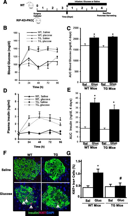 Figure 3. Inactivation of PKCζ inhibits glucose-induced β-cell proliferation in 4-day glucose-infused RIP-KD-PKCζ TG mice. A: Schematic representation of the experiments and timeline. Catheters were placed in 8-week-old male TG and WT mice and 3 days later glucose (Gluc) or saline (Sal) was infused for 4 days. Blood glucose and plasma insulin were measured daily until mice were sacrificed and pancreata harvested for immunohistochemical analysis. Blood glucose (B), area under the curve (AUC) for the blood glucose values (C), and plasma insulin (D) and AUC (E) for the plasma insulin values from saline-infused WT (n = 7) or TG (n = 8) mice and glucose-infused WT (n = 17) or TG (n = 18) mice. F: Representative photomicrographs of islets in mouse pancreas sections stained for insulin, DAPI, and Ki67 with arrows pointing to Ki67+ insulin+ cells. G: Quantitation of β-cell proliferation by measuring the number of Ki67+ insulin+ cells in the pancreas sections from the mice described in F. Results are means ± SEM. *P < 0.05 vs. same type of mice infused with saline; #P < 0.05 vs. WT mice infused with glucose.