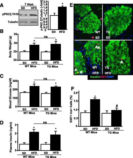 Figure 4. Inactivation of PKCζ inhibits β-cell proliferation in 1-week HFD–fed RIP-KD-PKCζ TG mice. A: Representative image of a Western blot showing PKCζ phosphorylation in mouse islets from WT mice fed for 1 week with SD or HFD and the densitometric quantitation of islets from n = 4 mice. Body weight (B), blood glucose (C), and plasma insulin (D) of WT and TG male mice (9 weeks old) fed with SD or HFD for 7 days. E: Representative photomicrographs of islets in pancreas sections from these mice stained for insulin, DAPI, and Ki67 with arrows pointing to Ki67+ insulin+ cells. F: Quantitation of β-cell proliferation by measuring the number of Ki67+ insulin+ cells in the pancreas sections from the mice described in D. Results are means ± SEM of SD-fed WT (n = 6) or TG (n = 8) mice and HFD-fed WT (n = 8) or TG (n = 8) mice. *P < 0.05 vs. same type of mice fed SD; #P < 0.05 vs. WT fed HFD.