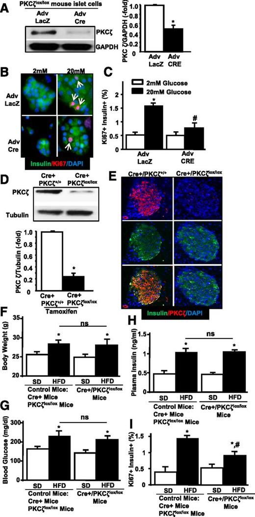 Figure 5. Downregulation of PKCζ inhibits glucose-mediated β-cell replication in vitro and in 1-week HFD–fed βPKCζ-KO mice. A: Representative image of a Western blot showing the expression of PKCζ in protein extracts from islet cells from PKCζlox/lox mice infected with Adv.LacZ or Adv.Cre and the densitometric quantitation of islets from n = 3 mice. B: Representative photomicrographs of PKCζlox/lox mouse islet cell cultures transduced with Adv.LacZ or Adv.Cre, treated with 2 or 20 mmol/L glucose and stained for insulin, Ki67, and DAPI. Arrows indicate Ki67+ insulin+ cells. C: Quantitation of n = 5 experiments as in B in duplicate. Results are means ± SEM. *P < 0.05 vs. Adv.LacZ 2 mmol/L; #P < 0.05 vs. Adv.LacZ 2 mmol/L. D: Representative image of a Western blot showing the level of PKCζ in mouse islets from Cre+/PKCζ+/+ and Cre+/PKCζlox/lox (βPKCζ-KO) mice treated with TM for 5 days and the densitometric quantitation of n = 3 mice per condition. Results are means ± SEM. *P < 0.05 vs. Cre+/PKCζ+/+. E: Immunostaining for insulin, PKCζ, and DAPI of pancreas sections from Cre+/PKCζ+/+ and Cre+/PKCζlox/lox mice. Body weight (F), blood glucose (G), and plasma insulin (H) of Cre+ (Cre+/PKCζ+/+) and PKCζlox/lox (Cre−/PKCζlox/lox) (control) mice and Cre+/PKCζlox/lox mice (9 weeks old) fed with SD or HFD for 7 days. Results are means ± SEM of SD-fed control (n = 9) or Cre+/PKCζlox/lox mice (n = 5) and HFD-fed control (n = 10) or Cre+/PKCζlox/lox KO mice (n = 5). *P < 0.05 vs. same type of mice fed SD. I: Quantitation of β-cell proliferation by measuring the number of Ki67+ insulin+ cells in the pancreas sections from the mice described in F–H. *P < 0.05 vs. same type of mice fed SD; #P < 0.05 vs. control mice fed HFD.