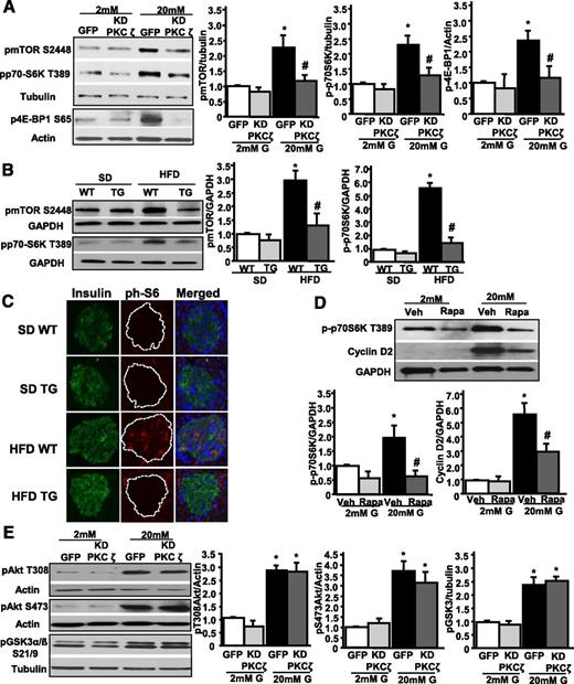 Figure 7. Glucose-mediated and HFD-induced activation of mTOR is impaired by inhibiting PKCζ activity. A: Representative image of a Western blot showing phosphorylation of Ser2448-mTOR, Thr389-p70S6K, and 4E-BP1 in protein extracts from INS-1 cells transduced with Adv.GFP or Adv.KD-PKCζ and treated with 2 or 20 mmol/L glucose (G) for 24 h. B: Representative image of a Western blot showing phosphorylation of Ser2448-mTOR and Thr389-p70S6K in protein extracts from islets from WT and TG mice fed for 7 days with SD or HFD and the densitometric quantitation of these signals in n = 4 experiments/mice. Results are means ± SEM. *P < 0.05 vs. 2 mmol/L Adv.GFP or SD-fed mice; #P < 0.05 vs. 20 mmol/L Adv.GFP or HFD-WT mice. C: Representative microphotographs of pancreatic sections from WT and TG mice fed for 7 days with SD or HFD and stained for insulin (green), phosphoS6 (red), and DAPI (blue). Notice the increase in phosphoS6 staining in islets from WT mice fed HFD compared with TG mice fed HFD or SD-fed mice. Islets are outlined with a discontinuous white line. D: Representative image of a Western blot showing the expression of cyclin-D2 in INS-1 cells treated with vehicle (Veh) or rapamycin (Rapa) and 2 or 20 mmol/L glucose for 24 h and the densitometric quantitation of cyclin-D2 in n = 4 experiments. Results are means ± SEM. *P < 0.05 vs. 2 mmol/L Veh; #P < 0.05 vs. 20 mmol/L Veh. E: Representative image of a Western blot showing the phosphorylation of Akt and GSK3α/β in protein extracts from INS-1 cells incubated with 2 or 20 mmol/L glucose for 24 h. Results are means ± SEM. *P < 0.05 vs. 2 mmol/L Adv.GFP.