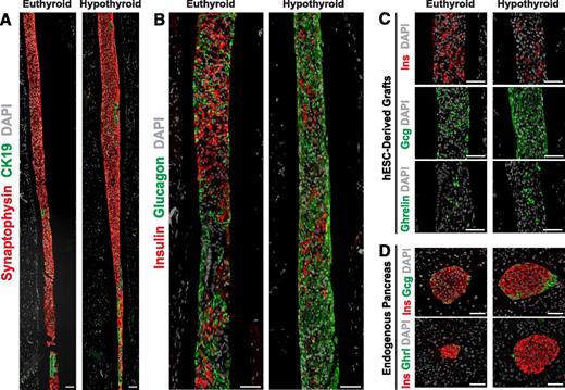 Figure 5. Immunofluorescent staining for pancreatic endocrine hormones in hESC-derived grafts and the endogenous pancreas from euthyroid or chronic hypothyroid mice at 27 weeks posttransplant. Low-magnification images of the hESC-derived grafts from mice with euthyroid or chronic hypothyroid treatments showing immunofluorescent staining for endocrine (synaptophysin; red) and ductal (CK19; green) populations (A) and insulin (red) and glucagon (green) cell populations (B). C: Representative high-magnification images of hESC-derived grafts from euthyroid or chronic hypothyroid mice stained for insulin (Ins; red), glucagon (Gcg; green), or ghrelin (green). D: Images of representative islets in the endogenous pancreas stained for insulin (red) and glucagon (green) or ghrelin (Ghrl, green). DAPI (4′,6-diamidino-2-phenylindole) nuclear staining is shown in gray for all images. All scale bars = 50 μm.