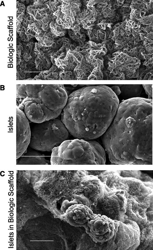 Figure 2. Scanning electronic micrograph of the biologic scaffold in vitro. A: Plasma/thrombin mix. Fibrin polymerizes forming an intricate three-dimensional network (bar = 5 µm). B: Untreated human islet cell surface in culture medium (bar = 50 µm). C: Human islets embedded within the biologic scaffold. The polymerized fibrin forms an orthomorphic matrix around the islet surface (bar = 50 µm).