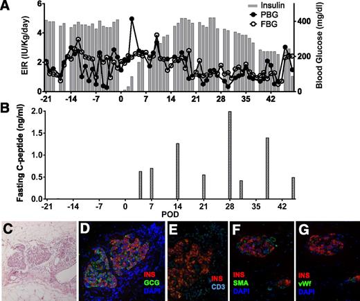 Figure 8. Intraomental allogeneic islet transplantation in a diabetic nonhuman primate. A diabetic cynomolgus monkey received 9,347 IEQ/kg allogeneic islets in the omentum under the cover of clinically relevant immunosuppression therapy. A: Exogenous insulin requirement (EIR) (IU/kg/day), FBG (mg/dL), and PBG. B: Fasting C-peptide (ng/mL) levels measured in the animal over the follow-up period. C–G: Histopathologic pattern of intraomental islet graft on day 49 posttransplant. C: Hematoxylin-eosin staining. D: Immunofluorescence microscopy for the evaluation of immunoreactivity for insulin (INS) (red), GCG (green), and nuclear dye (DAPI) (blue). E: Immunofluorescence for insulin (red) and CD3+ T cells (CD3) (cyan). F and G: Intrainsular neovasculogenesis. F: Immunofluorescence for insulin (red), vascular structure (SMA) (green), and DAPI (blue). G: Immunofluorescence microscopy for insulin (red), endothelial cells (vWF) (green), and DAPI (blue).