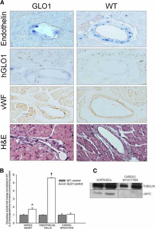 Figure 1. Overexpression of hGlo1 was confirmed in the ECs of GLO1 mouse hearts. A: In situ staining of proendothelin and hGlo1 showed mRNA expression of endothelin in WT and GLO1 mice, whereas hGlo1 mRNA was present only in GLO1 transgenic mice. Staining of ECs/vasculature was confirmed by vWF and hematoxylin and eosin (H&E) staining. B: GLO1 activity measured in the whole heart, ECs, and cardiomyocytes (n = 5). *P = 0.01 vs. whole heart WT-control; †P < 0.01 vs. endothelial cells WT-control. C: Representative cMYC Western blots of aortic ECs and cardiomyocytes from GLO1 mice show the presence of the tagged GLO1 protein only in ECs (each lane represents a different mouse).