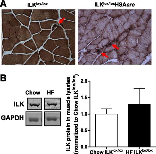 Figure 1. Protein expression of ILK in muscle. A: Immunohistochemical staining of ILK in paraffin-embedded gastrocnemius sections from chow-fed mice (n = 5). Representative images are presented at original magnification ×20, with the arrowheads indicating intact ILK expression in nonmyocytes. B: Western blotting of ILK in whole gastrocnemius muscle lysates from chow-fed and HF-fed ILKlox/lox mice (n = 3–4). Data are represented as mean ± SEM and are normalized to chow ILKlox/lox.
