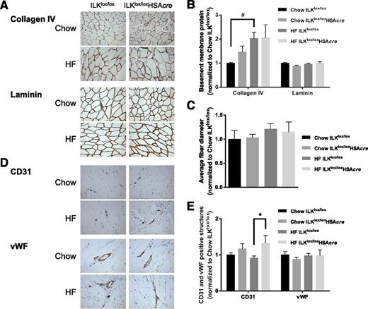 Figure 5. Muscle ECM deposition, fiber diameter, and vascular markers of the muscle-specific ILK-deficient mice. A: Immunohistochemical detection of ColIV and laminin in paraffin-embedded gastrocnemius sections (n = 5–9). Representative images are presented at original magnification ×20. B: Values of integrated intensity of staining for ColIV and laminin are presented as mean ± SEM, and data are normalized to chow ILKlox/lox. #P < 0.05. C: Average fiber diameter was manually measured from laminin staining images (n = 5–9). D: Immunohistochemical staining of CD31 and vWF in paraffin-embedded gastrocnemius sections (n = 5–9). Representative images are presented at original magnification ×20. E: Values represent mean ± SEM of numbers of CD31-positive structures or of areas occupied by vWF-positive structures. Data are normalized to chow ILKlox/lox. *P < 0.05.