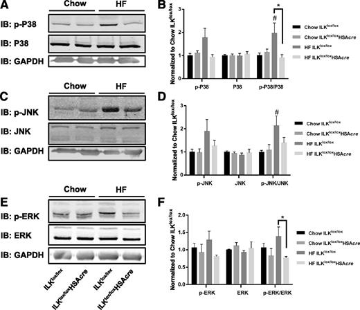 Figure 7. P38, JNK, and ERK MAPKs in the muscle. Western immunoblotting (IB) of p-P38 and total P38 (A), p-JNK and total JNK (C), and p-ERK and total ERK (E) in gastrocnemius homogenates isolated from mice after the hyperinsulinemic-euglycemic clamp. Representative bands are presented (n = 4–6). B, D, and F: Quantitative data for the Western blotting. Data are represented as mean ± SEM and are normalized to chow ILKlox/lox. #P < 0.05 chow vs. HF with the same genotype. *P < 0.05.