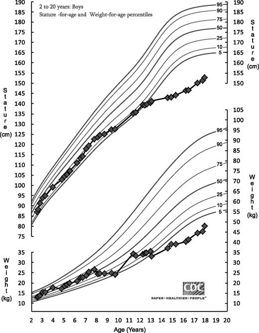 Figure 1. CDC growth chart showing the onset of growth delay during adolescence in the patient with Mauriac syndrome.