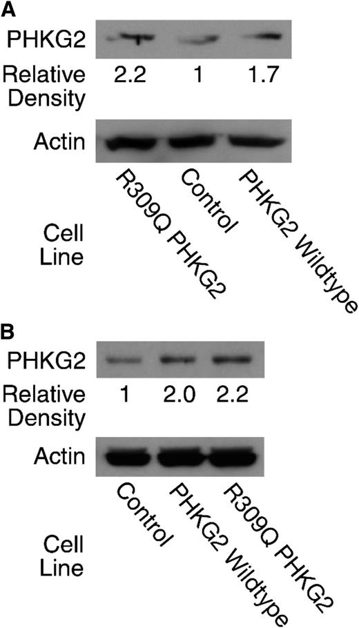 Figure 4. Immunoblot showing approximately twofold relative overexpression of the PHKG2 wild-type and R309Q PHKG2 mutant proteins in human liver Huh-7.5–derived cell lines. Vectors containing wild-type and the mutant PHKG2 gene sequences and a scrambled DNA sequence (Control) were used to generate stable cell lines with overexpressed wild-type PHKG2 or the mutant R309Q PHKG2 proteins. Cell lines shown in panel A were generated with a plasmid, and cell lines shown in panel B were generated with lentivirus, as described in the research design and methods section. The relative densities of the PHKG2 bands are shown. The PHKG2 immunoblot was stripped of antibody and reprobed with antibody to β-actin to demonstrate equal loading of cell protein across the lanes.
