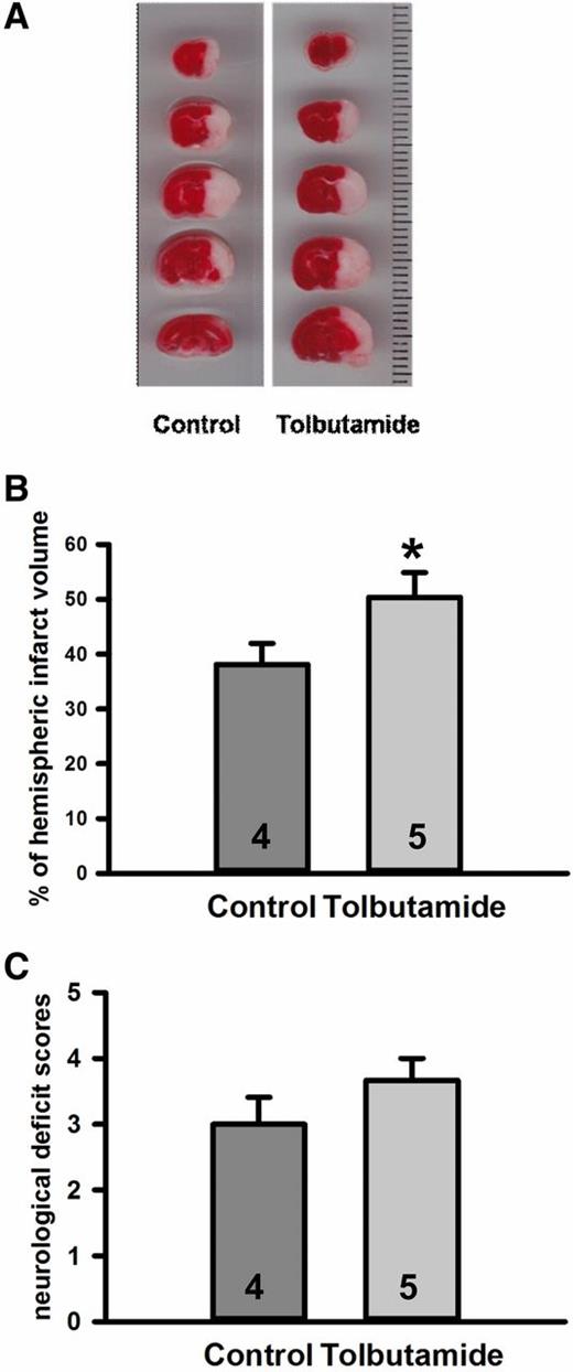 Figure 5. Effects of tolbutamide in increasing infarct volume in mouse pMCAO model. Tolbutamide (100 mg/kg in DMSO) or DMSO (0.1%) alone (vehicle-treated control group) was intraperitoneally administered to the mice 20 min before the onset of pMCAO. Infarct volume was assessed 24 h after MCAO. A: Representative TTC images. B: Effects of tolbutamide (100 mg/kg i.p.) are shown on brain infarct volume compared with the vehicle-treated control animals. *P = 0.044 by Student t test. C: The 6-point standard scale was used for the neurological deficit score in mice 24 h after pMCAO. The tolbutamide-treated mice (n = 5) with pMCAO exhibited higher neurological deficit scores than the vehicle-treated group (n = 4), but the difference was not statistically significant (P = 0.193).