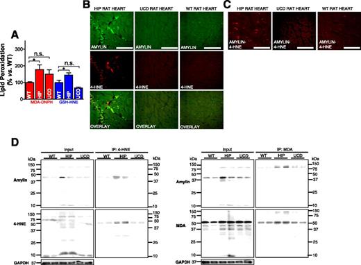 Figure 4. Aggregated amylin induces peroxidative membrane injury in the heart in a HIP rat. A: An LC-MS/MS method was applied to measure MDA in rat heart homogenates using derivatization of MDA with DNPH. The same method was applied to measure GSH-HNE in rat heart homogenates. B: Dual-immunofluorescence staining of amylin (green) and 4-HNE (red) in heart tissue sections from HIP rats, UCD rats, and WT rats (negative Ctls). C: PLA was performed with anti-amylin and anti–4-HNE antibodies on heart sections from WT, HIP, and UCD rats. PLA signal shows an overall consistency with 4-HNE-amylin appearing in clusters. Ten sections per sample from n = 4 rats in each group were investigated. Scale bars, 20 μm. D: Coimmunoprecipitation (IP)/immunoblot (IB) assays of 4-HNE and MDA (left and right panels, respectively) with amylin from WT, HIP, and UCD rat heart homogenates. Input: IB for amylin, 4-HNE or MDA, and GAPDH in the heart homogenates. IP: Anti–4-HNE and anti-MDA antibodies pulled down more amylin from HIP compared with WT and UCD heart homogenates. A representative blot from two independent experiments is shown. Data are presented as the mean ± SE. *P < 0.05, not statistically significant (n.s.).