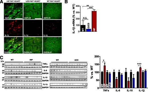 Figure 5. Aggregated amylin increases IL-1β synthesis in the hearts of rats expressing human amylin in the pancreas. A: Cardiac tissue from HIP rats was analyzed by immunofluorescence imaging with an IL-1β antibody. Myocyte staining for both amylin (green) and IL-1β (red) are readily observed. Scale bars, 20 μm. In contrast, UCD rats and WT rats (negative Ctls) lacked the IL-1β immunoreactivity signal in cardiac myocytes. Scale bars, 20 μm. B: Quantitative RT-PCR data showed elevated IL-1β mRNA levels in heart specimens from HIP rats vs. UCD rats and WT rats. n = 7 samples/group. Data are presented as the mean ± SE. C: Western blot analysis of IL-1β, TNF-α, IL-6, and IL-10 in hearts from HIP, UCD, and WT rats. A representative blot from two independent experiments is shown. *P < 0.05, **P < 0.01, ***P < 0.001, not statistically significant (n.s.).