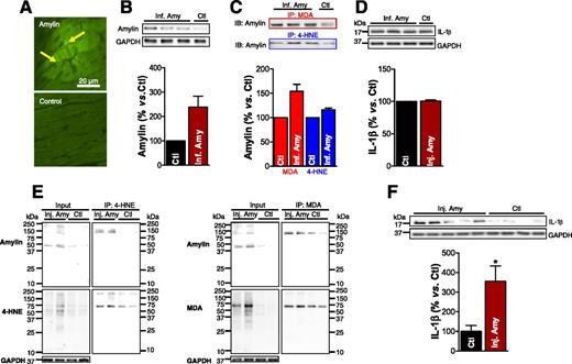 Figure 6. Langendorff perfusion of mice with aggregated amylin leads to the formation of amylin-4-HNE/MDA adducts and IL-1β activation. A: The 10 μmol/L biotinylated human amylin was recirculated in an isolated mouse heart on a Langendorff apparatus for 2 h. Fluorescence imaging shows binding of fluorescein isothiocyanate-avidin to the circulated biotinylated human amylin, thus demonstrating amylin deposition (arrows) in the heart. B–D: Isolated mouse hearts were perfused with 10 μmol/L aggregated human amylin (n = 3; Inf. Amy) or Tyrode solution (n = 1; Ctl) for 2 h on a Langendorff system, followed by a 10-min washout. B: Western blot measurement of amylin incorporated in the Langendorff perfused hearts. C: 4-HNE and MDA were immunoprecipitated, and the amylin level in the immunoprecipitate was measured by Western blot. D: Western blot analysis of IL-1β in Inf. Amy vs. Ctl hearts. E: C57BL/6 mice were intravenously injected with 2 μg/g body wt aggregated human amylin (n = 4; Inj. Amy) or saline (n = 4; Ctl). Coimmunoprecipitation (IP)/immunoblot (IB) assays of 4-HNE and MDA (left and right panels, respectively) with amylin from amylin-injected and Ctl mice heart homogenates. Input: IB for amylin, 4-HNE or MDA, and GAPDH in the heart homogenates. IP: anti–4-HNE and anti-MDA antibodies pulled down more amylin from amylin-injected compared with Ctl mouse heart homogenates. F: IL-1β level in hearts from mice injected with human amylin vs. Ctl. A representative blot from two independent experiments is shown. Data are presented as the mean ± SE. *P < 0.05.