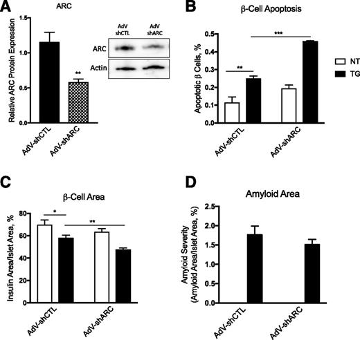 Figure 1. ARC knockdown increases amyloid-induced β-cell apoptosis and β-cell loss without altering amyloid formation. Nontransgenic (NT) and hIAPP transgenic (TG) islets were transduced with AdV-shCTL or AdV-shARC and then cultured for 144 h in 16.7 mmol/L glucose. Islet protein was collected to determine knockdown efficiency (A), and islets were then fixed for histological determination of rates of β-cell apoptosis (B), β-cell area (C), and amyloid severity (D). n = 4–5. *P < 0.05, **P < 0.01, ***P < 0.001.