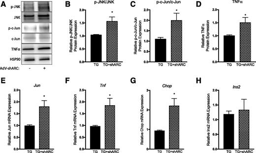 Figure 4. ARC knockdown increases JNK pathway activation in amyloid-forming islets. hIAPP transgenic islets were cultured in the absence (TG) or presence (TG+shARC) of AdV- shARC for 144 h in 16.7 mmol/L glucose. Islet protein lysates were analyzed by immunoblotting (A) for quantification of phosphorylated (p)-JNK (B), p-c-Jun (C), and TNF-α (D) expression. Alternatively, mRNA was isolated, cDNA was synthesized, and qRT-PCR was performed to determine the relative mRNA expression of Jun (E), Tnf (F), Chop (G), and Ins2 (H). n = 3–4. *P < 0.05.