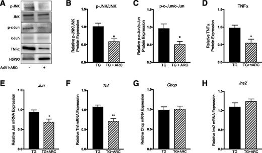Figure 5. ARC overexpression reduces JNK pathway activation in amyloid-forming islets. hIAPP transgenic islets were cultured in the absence (TG) or presence (TG+ARC) of AdV-hARC overexpression for 144 h in 16.7 mmol/L glucose. Islet protein lysates were analyzed by immunoblotting (A) for quantification of phosphorylated (p)-JNK (B), p-c-Jun (C), and TNF-α (D) expression. Alternatively, mRNA was isolated, cDNA was synthesized, and qRT-PCR was performed to determine the relative mRNA expression of Jun (E), Tnf (F), Chop (G), and Ins2 (H). n = 3–4. *P < 0.05, **P < 0.01.