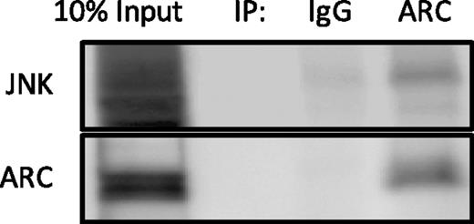 Figure 6. ARC binds JNK in hIAPP transgenic islets. hIAPP transgenic islets transduced with AdV-ARC were cultured for 144 h in 16.7 mmol/L glucose, and total cell lysates were collected. Protein lysates were then immunoprecipitated (IP) with IgG or ARC antibody, and immunoblot analysis was performed for the presence of JNK and ARC. n = 3.