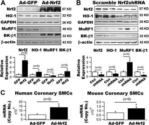 Figure 2. Regulation of HO-1, MuRF1, and BK-β1 expressions in cultured coronary SMCs by Nrf2. A: Ad-Nrf2 transduction (50 MOI) produced a 6.8-fold increase in Nrf2 expression and a 2.1-fold increase in HO-1 expression in human coronary SMCs. These changes were associated with a 66.2% reduction in MuRF1 expression and a 2.3-fold increase in BK-β1 expression (n = 9 culture plates). B: Transduction with Ad-Nrf2 shRNA (50 MOI) in human coronary arterial SMCs resulted in a 58.9% knockdown in the expression of Nrf2, a 41.2% reduction in that of HO-1, a threefold upregulation in that of MuRF1 and a 68.9% downregulation in that of BK-β1. Transduction with Ad-GFP or Ad-scramble RNA served as controls (n = 9 culture plates). C: Adenoviral delivery of Nrf2 (50 MOI) enhanced the BK-β1 mRNA levels by 2.6-fold and 1.6-fold in cultured human and mouse coronary SMCs, respectively (n = 9 culture plates). *P < 0.05 vs. controls. Ctrl, control.