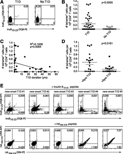Figure 2. Enumeration of InsB:DQ8 tetramer+ cells from HLA-DQ8+ patients with T1D and individuals without diabetes. A: Representative flow cytometry plots showing dual InsB:DQ8 tetramer+ stained cells concatenated from six patients with T1D patients (left) and four concatenated DQ8+ individuals without diabetes (right). Cells were gated on size, single cells, live, CD20−, CD33−, CD123−, CD8α−, CD3ε+, CD4+. B: Frequency of insulin-tetramer+ cells/1 million CD4+ T cells from all patients with T1D (n = 37) and control subjects without diabetes (n = 26; biological replicates). C: Correlation of the frequency of tetramer+ cells with disease duration for all patients with T1D. D: Comparison of the frequency of tetramer+ cells in individuals with T1D duration shorter and longer than 5 years. E: Flow cytometry plots showing dual InsB:DQ8 (top) and HA:DR4 (bottom) tetramer staining within peripheral blood CD4+ T cells from five DR4+/DQ8+ subjects with new-onset after 10 days of in vitro stimulation with modified InsB10–23 or HA306–318 (data are from two independent experiments). Bars represent the mean. The Mann-Whitney U test for nonparametric data (B and D) or linear regression (C) was used to determine significance. PE, R-phycoerythrin.