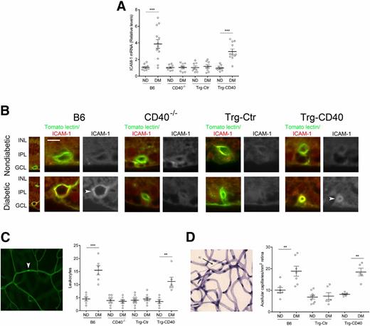 Figure 1. CD40 expression in Müller cells from diabetic mice promotes upregulation of ICAM-1 in the retina and vascular changes of early diabetic retinopathy. A: At 2 months of diabetes, retinas from diabetic B6, CD40−/−, Trg-Ctr, and Trg-CD40 mice (DM) as well as from nondiabetic (ND) control animals were collected and used for mRNA extraction. mRNA levels of ICAM-1 were assessed by real-time quantitative PCR using 18S rRNA as the internal control. One nondiabetic B6 mouse was given an arbitrary value of 1, and data are expressed as the fold-increase compared with this animal. The horizontal bars represent mean ± SEM (n = 8–13 animals per group). B: At 2 months of diabetes, retinal sections were incubated with anti–ICAM-1 monoclonal antibody and tomato lectin (n = 6 mice/group). GCL, ganglion cell layer; INL, inner nuclear layer; IPL, inner plexiform layer. Arrowheads show blood vessels with increased ICAM-1 expression. Scale bar, 10 μm. C: At 2 months of diabetes, adherent leukocytes in the retinal vasculature of diabetic and nondiabetic control mice were quantified by labeling with concanavalin A. Representative image shows an adherent leukocyte (arrowhead) within the vasculature of a diabetic B6 mouse. D: At 8 months of diabetes, retinal digests were examined for the presence of degenerate capillaries. The horizontal bars represent the mean ± SEM (n = 6–10 animals per group). Representative image shows an acellular capillary (arrow) in the retinal digest of a diabetic B6 mouse. **P < 0.01, ***P < 0.001 by ANOVA.