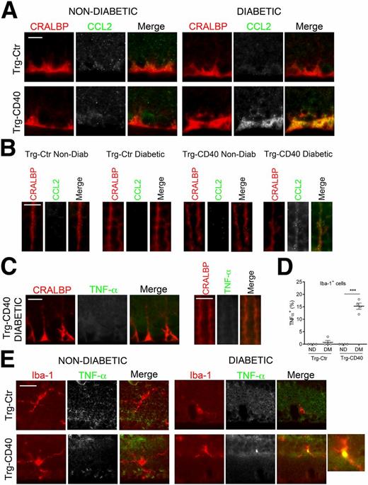 Figure 3. Diabetic transgenic mice that express CD40 in retinal Müller cells upregulate CCL2 in Müller cells and TNF-α in microglia/macrophages. A and B: Retinal sections from diabetic Trg-Ctr and Trg-CD40 mice at 2 months of diabetes and from nondiabetic controls were incubated with anti-CCL2 plus anti-CRALBP antibody. CCL2 expression at the level of Müller cell end feet (ganglion cell layer) (A) and at the level of Müller cells stalks (outer plexiform layer) (B). C: Sections were incubated with anti–TNF-α plus anti-CRALBP antibody. Müller cell end feet and stalk areas are shown. D and E: Retinal sections were incubated with anti–TNF-α monoclonal antibody plus anti–Iba-1 antibody. D: Sections were analyzed to determine the percentages of Iba-1+ cells in diabetic mice (DM) and nondiabetic (ND) mice that were stained with anti–TNF-α antibody. ***P < 0.001. E: Images represent microglia/macrophages present in the inner plexiform layer (n = 4 mice/group). Scale bars, 10 μm.
