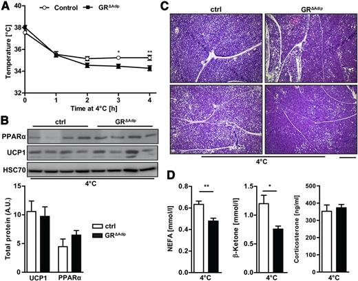 Figure 3. Reduced thermogenesis in GR∆Adip mice. A: Body temperatures of GR∆Adip and control (ctrl) mice upon acute exposure to 4°C for the indicated time (n ≥6/genotype). B: Western blot analysis and quantification of UCP1 and PPARα protein levels in BAT of 4-h cold-exposed mice. HSC70 was used as a loading control. Protein bands were quantified by densitometry, and total protein expression was corrected for the respective loading control (n = 4/genotype). C: Representative H-E staining of BAT sections from GR∆Adip and ctrl mice after 4 h of cold exposure. Scale bar indicates 200 µm. D: Plasma NEFA, corticosterone, and blood β-ketone level of 4-h cold-exposed mice. NEFA was determined by colorimetric assays and corticosterone was measured by ELISA (n ≥6/genotype). Data are shown as the mean ± SEM. *P < 0.05; **P < 0.01.