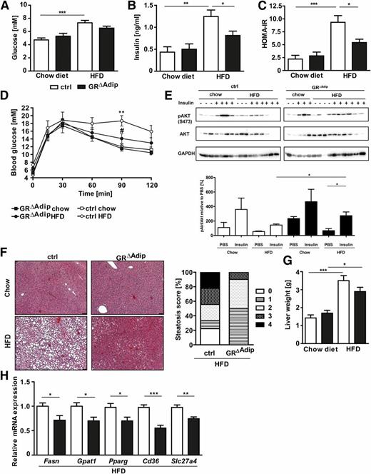 Figure 6. Adipocyte-specific GR loss improves glucose tolerance and hepatic steatosis under HFD conditions. A: Blood glucose levels of 12 h–fasted control (ctrl) and GR∆Adip mice (n = 5–10 mice/genotype). Plasma insulin levels (B) and HOMA-IR (C) of 12 h–fasted ctrl and GR∆Adip mice (n = 5–10 mice/genotype). Insulin concentrations were determined by ELISA. D: GTT 18 weeks after chow/HFD. Glucose was administered by intraperitoneal injection (2 g/kg body weight) after a 16-h fast. Blood glucose levels were determined at indicated time points (n = 5–10/genotype). E: Western blot analysis of insulin-stimulated phosphorylation of AKT in muscle (1 unit/kg body weight) from ctrl and GR∆Adip mice after chow or HFD. F: Representative H-E staining of liver sections from ctrl and GR∆Adip mice after chow or HFD and histopathological characterization of liver phenotypes from HFD mice (n ≥9/genotype). Steatosis score 1, <5%; score 2, 5–20%; score 3, >20%; score 4, >50%. Scale bar indicates 25 µm. G: Comparison of wet weight of liver after chow and HFD of the indicated genotypes (n = 5–10 mice/genotype). H: Relative mRNA expression of Fasn, Gpat1, Pparg, Cd36, and Scl27a4 in liver as determined by qRT-PCR of HFD-fed ctrl and GR∆Adip mice. Ct values were normalized to Actb (n = 8–10/genotype). For all analyses, ctrl and GR∆Adip mice received either a chow diet or an HFD for 18–20 weeks starting at weeks 3–5 after birth; data are shown as the mean ± SEM. *P < 0.05; **P < 0.01; ***P < 0.001; #P < 0.05 (GR∆Adip HFD vs. ctrl HFD).