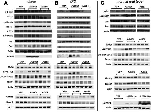 Figure 3. Signaling pathways and transcriptional factors in livers transduced by Ad36E4ORF1 in db/db (A), DIO (B), and normal wild-type (C) mice. Quantification of Western blots is provided in Supplementary Tables 2–4.