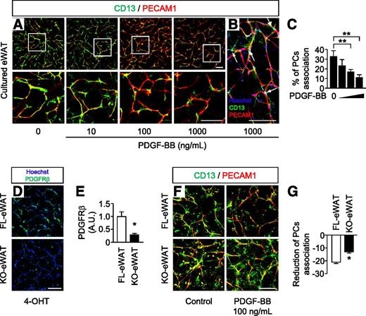 PDGFRβ Regulates Adipose Tissue Expansion and Glucose Metabolism via ...