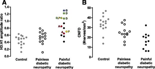 Figure 5. Tibial H-reflex RDD exhibits variability in patients with painful diabetic neuropathy but does show a relationship with pain VAS. A: Individual values for RDD at 1-Hz stimulation in control subjects (filled gray circles) and patients with painless (open circles) or painful (filled black/colored circles) diabetic neuropathy. Antineuropathic pain medication is indicated by letters adjacent to the relevant data point. A, amitriptyline; D, duloxetine; G, gabapentin; P, pregabalin. B: Dot plots of individual values for CNFD in control subjects and patients with painless or painful diabetic neuropathy.