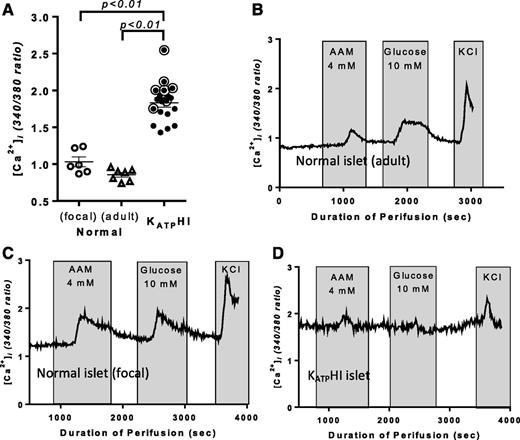 Figure 2. [Ca2+]i dynamics in KATPHI and control islets. [Ca2+]i dynamics were measured in isolated cultured islets using Fura-2 as calcium indicator. A: Basal [Ca2+]i in control infant islets isolated from the normal pancreas region of focal cases (n = 6), control adult islets (n = 7), and KATPHI islets (n = 19). (Note: the circled cases were used for 13C tracing experiments). B–D: [Ca2+]i in adult control islets (B), age-matched infant control islets from normal pancreas region of focal HI (C), and KATPHI islets (D) in response to 4 mmol/L AAM and 10 mmol/L glucose stimulation, followed by 30 mmol/L KCl stimulation (representative cases are shown). sec, seconds.