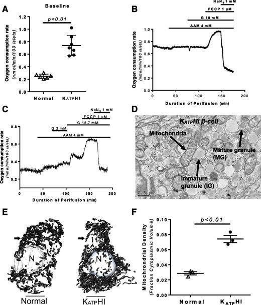 Figure 3. OCR and mitochondrial density in KATPHI and control islets. KATPHI and control islets were placed in respiratory chamber, and OCR was measured using phosphorescence quenching method as previously described (21). A: Basal OCR in control (n = 6) and KATPHI (n = 7) islets. B: OCR in KATPHI islets (n = 6) perifused with glucose-free KRBB and then exposed to 4.0 mmol/L AAM, 10 mmol/L glucose, 1 μmol/L FCCP, and 1 mmol/L NaN3. C: OCR in control islets (n = 6) perifused with glucose-free KRBB and then exposed to 4.0 mmol/L AAM, 3 and 16.7 mmol/L glucose, and FCCP and then NaN3. Note: B and C showed representative data, the signals were collected every 10 s, and for clarity we present typical experiments. D–F: Enhanced mitochondrial density in KATPHI β-cells. D shows the colocalization of mitochondria with secretory granules in a KATPHI β-cell, which are clearly identified by the presence of dense core/mature secretory granules and immature granular contents. Serial block face-scanning electron microscopy–derived digital reconstructions of β-cells from control and KATPHI tissue showing nuclear (N) and mitochondrial (arrow) structures (E) were used to determine relative mitochondrial densities evaluated (F) (n = 3 for control and KATPHI β-cells).