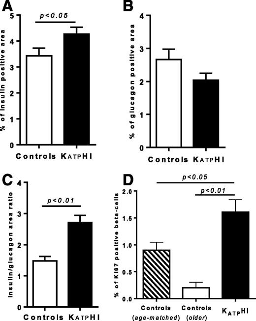 Figure 5. β/α-Cell mass and β-cell proliferation in pancreas from KATPHI and control infants. Pancreatic tissue slides were obtained from KATPHI, age-matched autopsy or surgical control subjects and older control subjects and immunolabeled for insulin, glucagon, and Ki67. A: β-Cell area as the percentage of the total pancreatic area containing islet cells positive for insulin among all cells in the slide in KATPHI (n = 40) and age-matched control (n = 29) subjects. B: α-Cell area as the percentage of the total pancreatic area containing islet cells positive for glucagon among all cells in the slide in KATPHI (n = 40) and age-matched control (n = 29) subjects. C: Ratio of β-cell to α-cell area in KATPHI (n = 40) and age-matched control (n = 29) subjects. D: Percentage of Ki67-positive cells among insulin-positive cells in KATPHI (n = 40), older control pancreata (n = 5), and age-matched control pancreata (n = 29).