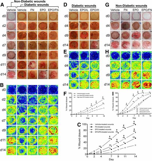 Figure 1. Topical EPO application accelerates wound closure and increases blood flow in the regenerating skin of diabetic wounds in a dose-dependent manner; an effect potentiated by FN. In the regenerating skin of nondiabetic wounds, topical application of FN does not affect wound closure and blood flow rates. Representative set of photographic images (A) and the corresponding laser Doppler scans (B) of a vehicle-, an FN-, an EPO-, and an EPO/FN-treated burn wound in a nondiabetic and diabetic pig on days (d) 0, 2, 4, 7, 9, 11, and 14. C: Wound closure rates of the vehicle-, the FN-, the EPO-, and the EPO/FN-treated burn wounds in the diabetic pigs. Representative set of photographic images (D) and the corresponding laser Doppler scans (E) of a vehicle-, a low-dose EPO-, and a high-dose EPO-treated burn wound in a diabetic pig on days 0, 4, 9, and 14. F: Wound closure rates of the vehicle-, the low-dose EPO-, and the high-dose EPO-treated burn wounds in the diabetic pigs. Representative set of photographic images (G) and the corresponding laser Doppler scans (H) of a vehicle-, an FN-, an EPO-, and an EPO/FN-treated burn wound in a nondiabetic pig on days 0, 4, 9, and 14. The white circles in the laser Doppler scans represent the burn wound area on day 0. The dark blue color represents nonvascularized regions, and the yellow and red colors represent vascularized regions with the red-colored regions depicting regions that are more vascularized than the yellow-colored regions. I: Wound closure rates of the vehicle-, FN-, EPO-, and EPO/FN-treated burn wounds in the nondiabetic pigs. The sample size in each treatment group was 12 except in the low-dose EPO-treated burn wound group, where the sample was 6. *P < 0.05; **P < 0.01, significance of the difference between the vehicle-treated burn wounds and the other treatments according to the results of a two-way ANOVA with Bonferroni correction. †P < 0.05, significance of the difference between 1) the EPO-treated or EPO/FN-treated burn wounds and the FN-treated burn wounds and 2) the high-dose EPO-treated burn wounds and the low-dose EPO-treated burn wounds according to the results of a two-way ANOVA with Bonferroni correction. EPO/H, high-dose EPO-treated burn wounds; EPO/L, low-dose EPO-treated burn wounds.