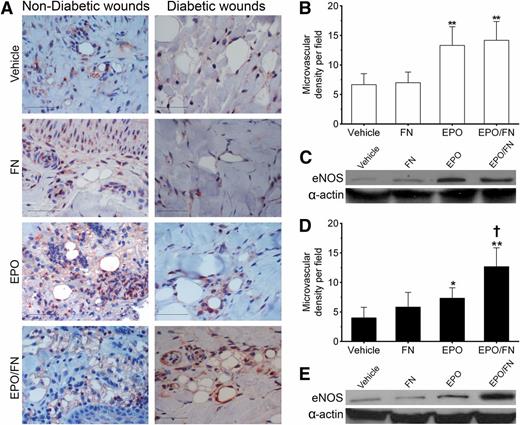 Figure 2. Topical EPO application increases MVD and eNOS expression in the regenerating skin of diabetic wounds, and these effects are potentiated by FN. A: Representative set of micrographs that show immunohistochemical staining for CD31 expression by vascular endothelial cells of the capillaries in the regenerating skin of the vehicle-, FN-, EPO-, and EPO/FN-treated burn wounds of the nondiabetic pigs (left panel) and of the diabetic pigs (right panel) that were collected after 14 days of treatment. The MVD in the regenerating skin was determined by counting the number of capillaries in five random microscopic fields (×20 magnification) under a light microscope at each wound site. B: The MVD in the regenerating skin of the vehicle-, the FN-, the EPO-, and the EPO/FN-treated burn wounds of the nondiabetic pigs. C: Representative Western blots of eNOS expression in tissues that were collected on day 14 and then measured in lysates that were prepared from the regenerating skin of vehicle-, FN-, EPO-, and EPO/FN-treated burn wounds of the nondiabetic pigs. D: The MVD in the regenerating skin of the vehicle-, the FN-, the EPO-, and the EPO/FN-treated burn wounds of the diabetic pigs. E: Representative Western blots of eNOS expression in tissues that were collected on day 14 and then measured in lysates that were prepared from the regenerating skin of vehicle-, FN-, EPO-, and EPO/FN-treated burn wounds of the diabetic pigs. α-Actin was used to normalize protein loading, and the blots were derived from samples that were analyzed concomitantly on a separate gel. The sample size of each treatment group was 12, and data are expressed as the average of duplicate measurements ± SD for each treatment group. *P < 0.05 and **P < 0.01, significance of the difference between the vehicle-treated burn wounds and the other treatments according to the results of a one-way ANOVA with a Tukey post hoc test. †P < 0.05, significance of the difference between EPO/FN-treated and EPO-treated burn wounds according to the results of a one-way ANOVA with a Tukey post hoc test. Scale bars: 200 μm.