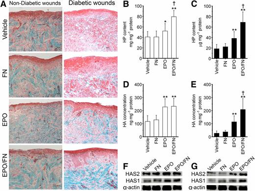 Figure 3. Topical EPO increases the amount of HP and HA synthesis in the regenerating skin of diabetic wounds, and this effect is potentiated by FN. A: Representative set of micrographs that shows immunohistochemical staining for the amount of HP by Masson trichrome staining in the regenerating skin of the vehicle-, FN-, EPO-, and EPO/FN-treated burn wounds of the nondiabetic pigs (left panel) and of the diabetic pigs (right panel) that were collected after 14 days of treatment. The HP content in regenerating skin of the vehicle-, the FN-, the EPO-, and the EPO/FN-treated burn wounds of the nondiabetic pigs (B) and of the diabetic pigs (C) on day 14. The HA amount in the regenerating skin of the vehicle-, the FN-, the EPO-, and the EPO/FN-treated burn wounds of the nondiabetic pigs (D) and of the diabetic pigs (E). Representative Western blots of HAS1 and HAS2 expression levels in tissue samples that were collected on day 14 and then measured in lysates that were prepared from the regenerating skin of the vehicle-, the FN-, the EPO-, and the EPO/FN-treated burn wounds of the nondiabetic pigs (F) and of the diabetic pigs (G). α-Actin was used to normalize protein loading, and the blots were derived from samples that were analyzed concomitantly and run on a separate gel. The sample size of each treatment group was 12, and the data are expressed as the average of duplicate measurements of the amount of HP or HA ± SD. *P < 0.05; **P < 0.01, significance of the difference between the vehicle-treated burn wounds and the other treatments according to the results of the one-way ANOVA with Tukey post hoc test. †P < 0.05, significance of the difference between EPO/FN-treated and EPO-treated burn wounds according to the results of a one-way ANOVA with a Tukey post hoc test. Scale bars: 200 μm.
