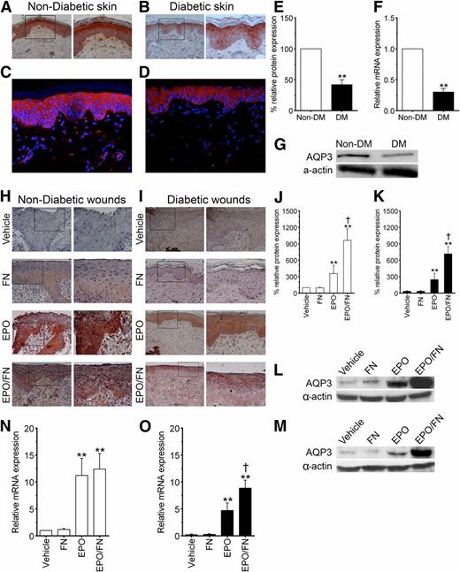 Figure 4. AQP3 expression is decreased in wound-free diabetic skin. Topical EPO application stimulates AQP3 expression in the regenerating skin of diabetic wounds, and this effect is potentiated by FN. Representative set of micrographs of immunohistochemical staining for AQP3 in the wound-free skin of a nondiabetic pig (A) and of a diabetic pig (B). Scale bars: left, 50 μm; right, 200 μm. Representative set of micrographs of immunofluorescence staining for AQP3 in the wound-free skin of a nondiabetic pig (C) and of a diabetic pig (D). E and G: Quantification (E) and representative Western blots (G) of AQP3 expression in the wound-free skin of diabetic pigs 30 days after diabetes induction in wound-free skin of the nondiabetic pigs. F: AQP3 mRNA levels of total RNA that was isolated from wound-free skin collected on day 30 after diabetes induction. Values are expressed as the mean ± SD of triplicate measurements of AQP3 protein expression and mRNA expression and as a percentage of the expression in wound-free nondiabetic skin (100%). Representative set of micrographs of immunohistochemical staining for AQP3 in the regenerating skin of the vehicle-, the FN-, the EPO-, and the EPO/FN-treated burn wounds of the nondiabetic pigs (H) and the diabetic pigs (I), which were collected after 14 days of treatment. Scale bars: left, 50 μm; right, 200 μm. Quantification of Western blot levels of AQP3 protein expression after a 14-day treatment of burn wounds in the nondiabetic pigs (J) and the diabetic pigs (K) with a vehicle-, an FN-, an EPO-, and an EPO/FN-containing gel. Values are expressed as the mean ± SD of triplicate measurements of AQP3 protein expression in vehicle-treated burn wounds of the nondiabetic pigs (100%). Representative Western blots of AQP3 protein expression in lysates of the regenerating skin of burn wounds from the nondiabetic pigs (L) and the diabetic pigs (M) after 14 days of treatment. α-Actin was used to normalize protein loading, and the blots were derived from samples that were concomitantly run on a separate gel. AQP3 mRNA levels of total RNA that was isolated from lysates of the regenerating skin of vehicle-, FN-, EPO-, and EPO/FN-treated burn wounds of the nondiabetic pigs (N) and the diabetic pigs (O). Values are expressed as the average ± SD of duplicate measurements of AQP3 mRNA expression and as a percentage of the expression in wound-free of nondiabetic skin (100%). **P < 0.01, significance of the difference between the vehicle-treated burn wounds and the other treatments according to the results of a two-way ANOVA with Bonferroni correction.†P < 0.05, significance of the difference between EPO/FN-treated burn wounds and the EPO-treated burn wounds according to the results of a two-tailed Student t test.