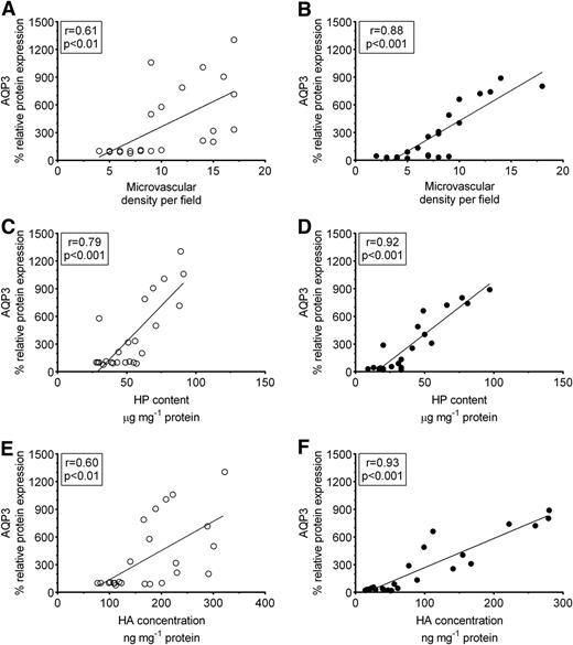 Figure 5. AQP3 protein expression correlates positively with the extent of angiogenesis and the amounts of HP and HA in the regenerating skin of diabetic wounds. AQP3 protein expression significantly correlates with the MVD (r = 0.61) (A), the amount of HP (r = 0.79) (C), and the amount of HA (r = 0.88) (E) in the burn wounds of the nondiabetic pigs. AQP3 protein expression also significantly correlates with the MVD (r = 0.88) (B), the amount of HP (r = 0.92) (D), and the amount of HA (r = 0.93) (F) in the burn wounds of the diabetic pigs. Each point represents the average of AQP3 protein expression, the MVD, and the amounts of HP and HA in six wounds.