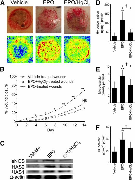 Figure 6. AQP3 inhibition by HgCl2 reduces the effect of topical EPO on the wound closure rate, the extent of angiogenesis, and the amounts of HP and HA in diabetic wounds. The wound closure and blood flow rates in the regenerating skin of diabetic pigs were determined after 14 days of treatment with the vehicle-, the high-dose EPO-, and the EPO/HgCl2-containing gels. A: Representative set of photographic images (top panel) and laser Doppler scans (bottom panel) of a vehicle-, EPO-, and an EPO/HgCl2-treated burn wound in the diabetic pig after 14 days of treatment. The dark blue color represents nonvascularized regions, and the yellow and red colors represent vascularized regions with red-colored regions representing regions that are more vascularized than the yellow-colored regions. B: The wound closure rates of the vehicle-, the EPO-, and the EPO/HgCl2-treated burn wounds of the diabetic pigs. Burn wounds (n = 6) in each treatment group in one of the diabetic pigs were assessed and compared. C: Representative Western blots of eNOS, HAS1, and HAS2 expression levels in tissues that were collected on day 14 and then measured in lysates that were prepared from the regenerating skin of the vehicle-, the EPO-, and the EPO/HgCl2-treated burn wounds of the diabetic pigs. α-Actin was used to normalize protein loading, and the blots were derived from samples that were concomitantly run on a separate gel. The amount of HA (D), MVD (E), and HP (F) in the regenerating skin of the vehicle-, the EPO-, and the EPO/HgCl2-treated burn wounds of the diabetic pigs. B: *P < 0.05; **P < 0.01, significance of the difference between the vehicle-treated burn wounds and the other treatments according to the results a two-way ANOVA with Bonferroni correction. D–F: **P < 0.01, significance of the difference between the vehicle-treated burn wounds and the other treatments according to the results of a one-way ANOVA with Tukey post hoc test; †P < 0.05, significance of the difference between the EPO/HgCl2-treated and EPO-treated burn wounds according to the results of a two-tailed Student t test.