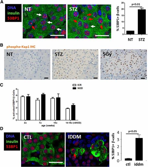 Figure 3. DDR in rodent models of diabetes. A: Immunostaining for 53BP1 in mouse β-cells in vivo after a single dose of 30 mg/kg STZ to wild-type mice. White and red arrows mark nuclei with nonactivated or activated 53BP1, respectively. Scale bars = 20 μm. Also shown is the quantification of the percentage of β-cell nuclei with nuclear 53BP1 foci. Untreated, n = 2 (NT); STZ (40 mg/kg) injected, n = 3. Error bars represent 1 SEM. B: Representative images from immunostaining for phospho-Kap1 in islets of control, single acute STZ-injected (200 mg/kg), and 5-Gy–irradiated mice. Nuclear accumulation of signal signifies Kap1 phosphorylation. Scale bars = 20 μm. C: Quantification of 53BP1 nuclear foci in islets of NOD and ICR control mice at various ages. D: Immunostaining for 53BP1 in healthy control (CTL) rats and in prediabetic LEW.1AR1-iddm rats and quantification of the 53BP1 nuclear foci in β-cells. Scale bar = 20 μm. IHC, immunohistochemistry; rdNOD, recently diagnosed nonobese diabetic mice; w, weeks.